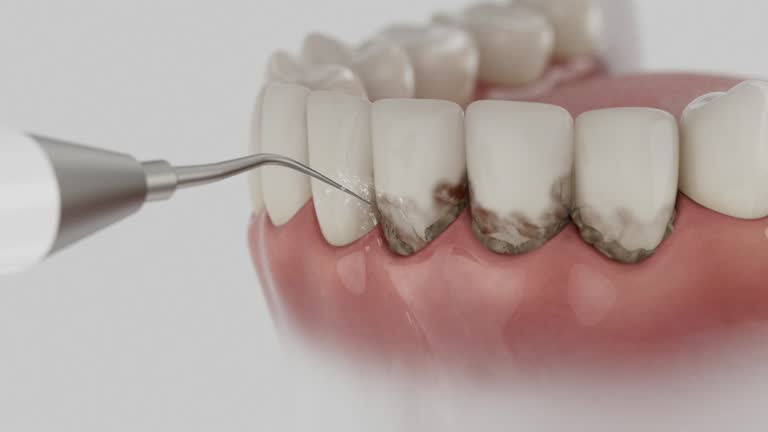 Reliable Dental contractor in Harrison, OH by Dentist Open Now